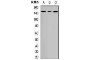 Western blot analysis of Tensin 2 (pY483) expression in A549 (A), Hela (B), NIH3T3 (C) whole cell lysates. (TENC1 抗体  (pTyr483))