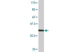 Western Blot detection against Immunogen (36. (PIK3R4 抗体  (AA 1259-1358))