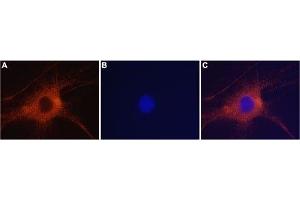 Expression of GluR6 in rat DRG neurons - Immunocytochemistry of rat dorsal root ganglion (DRG) neurons. (GRIK2 抗体  (Intracellular))
