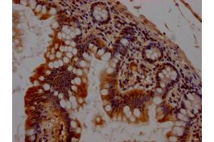 IHC image of ABIN7127424 diluted at 1:100 and staining in paraffin-embedded human small intestine tissue performed on a Leica BondTM system. (Recombinant CHEK1 抗体)