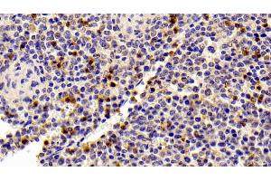 Immunohistochemistry (IHC) image for anti-S100 Calcium Binding Protein A8 (S100A8) (AA 1-89) antibody (ABIN7443995)