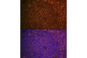 Immunofluorescence analysis of Mouse spleen using CST7 antibody (ABIN6131040, ABIN6139156, ABIN6139157 and ABIN6224188) at dilution of 1:100. (CST7 抗体  (AA 20-145))
