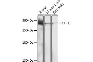 Western blot analysis of extracts of various cell lines, using CHD3 antibody (ABIN6133623, ABIN6138510, ABIN6138511 and ABIN6219455) at 1:1000 dilution. (CHD3 抗体  (AA 1900-2000))