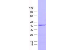 Western Blotting (WB) image for TAR (HIV-1) RNA Binding Protein 2 (TARBP2) protein (His tag) (ABIN2733236)