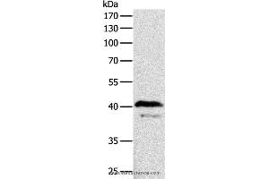 Western blot analysis of Mouse brain tissue, using ADAP1 Polyclonal Antibody at dilution of 1:500 (ADAP1 抗体)