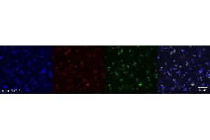 Immunohistochemistry (IHC) image for anti-Oligodendrocytic Myelin Paranodal and Inner Loop Protein (OPALIN) antibody (ABIN7456340) (OPALIN 抗体)