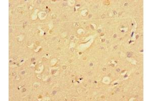Immunohistochemistry of paraffin-embedded human brain tissue using ABIN7159413 at dilution of 1:100 (Merlin 抗体  (AA 230-414))