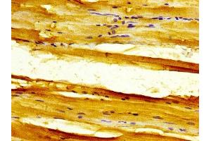 Immunohistochemistry (IHC) image for anti-Solute Carrier Family 11 (Proton-Coupled Divalent Metal Ion Transporters), Member 1 (SLC11A1) (AA 1-58) antibody (ABIN7161089)