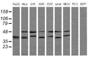 Image no. 2 for anti-Mitogen-Activated Protein Kinase Kinase 3 (MAP2K3) antibody (ABIN1499419) (MAP2K3 抗体)