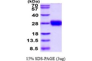 SDS-PAGE (SDS) image for Tissue Factor Pathway Inhibitor 2 (TFPI2) (AA 23-213) protein (His tag) (ABIN5777868) (TFPI2 Protein (AA 23-213) (His tag))