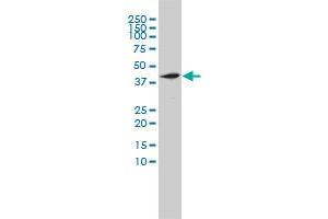 NOTCH2NL monoclonal antibody (M01), clone 2G12-2A5 Western Blot analysis of NOTCH2NL expression in HL-60 . (NOTCH2NL 抗体  (AA 1-236))