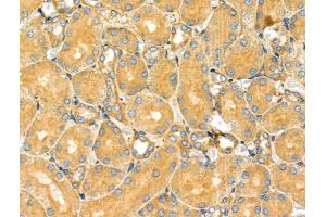 ABIN6263217 and ABIN6266832 at 1/100 staining Rat kidney tissue by IHC-P. (MAP4K4 抗体  (Internal Region))