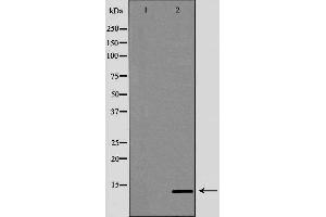 Western blot analysis of Mouse lung lysate, using SNCG Antibody. (SNCG 抗体  (C-Term))