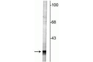 Western blot of rat cortical lysate showing specific labeling of the ~27 kDa Rab3 protein. (RAB3A 抗体  (N-Term))