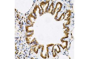 Immunohistochemistry (Paraffin-embedded Sections) (IHC (p)) image for anti-Heat Shock Protein 90kDa alpha (Cytosolic), Class B Member 1 (HSP90AB1) (AA 1-300) antibody (ABIN3021406)