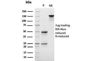 SDS-PAGE Analysis Purified Monospecific Mouse Monoclonal Antibody to LSP1 (LSP1/3042). (LSP1 抗体  (AA 174-278))