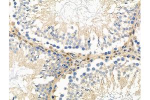ABIN6264642 and ABIN6276374 at 1/100 staining Rat testis tissue by IHC-P. (Retinoic Acid Receptor alpha 抗体  (N-Term))