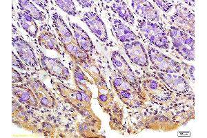 Formalin-fixed and paraffin embedded rat colon tissue labeled with Anti-Phospho-FoxO3a (Ser318/321) Polyclonal Antibody, Unconjugated (ABIN684688) at 1:200 followed by conjugation to the secondary antibody and DAB staining (FOXO3 抗体  (pSer318, pSer321))