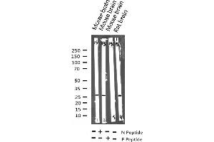 Western blot analysis of Phospho-p27 Kip1 (Thr187) expression in various lysates (CDKN1B 抗体  (pThr187))