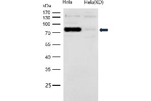 All lanes use the Antibody at 1:1K dilution for 1 hour at room temperature.