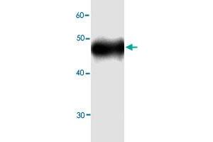 Western blot analysis in ALDOB recombinant protein with ALDOB monoclonal antibody, clone 5g898  at 1 : 1000 dilution. (ALDOB 抗体)
