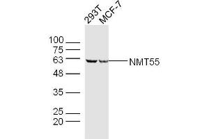 Lane 1: 293T lysates Lane 2: MCF-7 lysates probed with NMT55 Polyclonal Antibody, Unconjugated  at 1:300 dilution and 4˚C overnight incubation. (NONO 抗体  (AA 21-120))