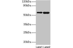 Western blot All lanes: SCP2 antibody at 2 μg/mL Lane 1: A549 whole cell lysate Lane 2: MCF-7 whole cell lysate Secondary Goat polyclonal to rabbit IgG at 1/10000 dilution Predicted band size: 59, 16, 35, 51, 7, 55, 57 kDa Observed band size: 59 kDa (SCP2 抗体  (AA 1-143))