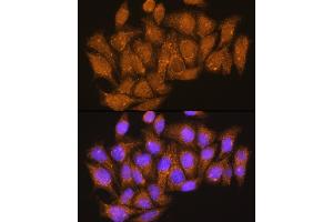 Immunofluorescence analysis of HeLa cells using V1E1 Rabbit pAb (ABIN1678795, ABIN3018056, ABIN3018057 and ABIN6220346) at dilution of 1:100. (ATP6V1E1 抗体  (AA 77-226))