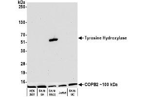 Western Blotting (WB) image for anti-Tyrosine Hydroxylase (TH) (AA 450-500) antibody (ABIN7449433)