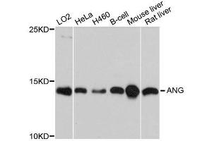 Western blot analysis of extracts of various cell lines, using ANG antibody. (ANG 抗体  (AA 25-147))