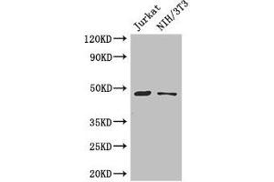 Western Blot Positive WB detected in: Jurkat whole cell lysate, NIH/3T3 whole cell lysate All lanes: SGK1 antibody at 3 μg/mL Secondary Goat polyclonal to rabbit IgG at 1/50000 dilution Predicted band size: 49, 60, 51, 48, 53 kDa Observed band size: 49 kDa (SGK1 抗体  (AA 247-406))