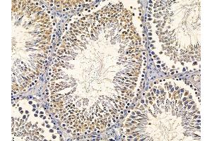 ABIN6260157 and ABIN6277857 at 1/100 staining rat testis tissue by IHC-P. (AurB/C 抗体  (N-Term))