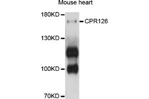 Western blot analysis of extracts of mouse heart, using GPR126 antibody (ABIN4903810) at 1:1000 dilution. (G Protein-Coupled Receptor 126 抗体)