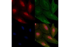 ABIN6257868 and ABIN6274110 staining  cells by IF/ICC.