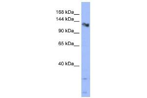 CHERP antibody used at 1 ug/ml to detect target protein. (CHERP 抗体  (Middle Region))
