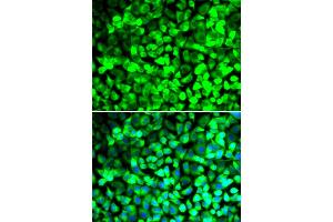 Immunofluorescence analysis of U2OS cells using EIF5 antibody (ABIN5973954). (EIF5 抗体)