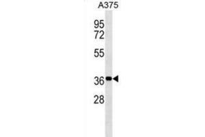 Western Blotting (WB) image for anti-Non-SMC Element 1 Homolog (NSMCE1) antibody (ABIN3000163) (NSMCE1 抗体)
