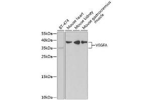 Western Blot Analysis using ABIN6150086 (VEGFA 抗体  (AA 1-147))