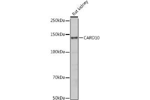 Western blot analysis of extracts of Rat kidney, using C antibody (ABIN6127549, ABIN6137937, ABIN6137938 and ABIN6223226) at 1:500 dilution. (CARD10 抗体  (AA 863-1032))