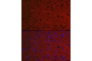 Immunofluorescence analysis of Rat brain using RA antibody (ABIN7269809) at dilution of 1:50. (RAB3A 抗体  (AA 100-200))