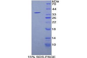 SDS-PAGE analysis of Mouse Sirtuin 6 Protein. (SIRT6 蛋白)