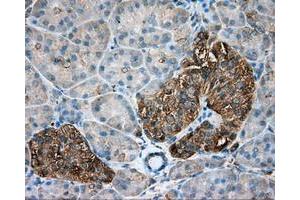 Immunohistochemical staining of paraffin-embedded Kidney tissue using anti-TUBA8 mouse monoclonal antibody. (TUBA8 抗体)