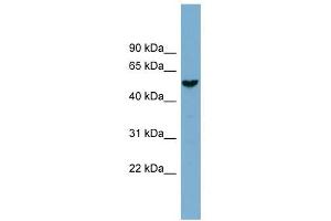 FAM83E antibody used at 1 ug/ml to detect target protein. (FAM83E 抗体  (Middle Region))