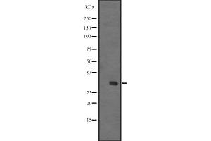 Western blot analysis of IGFBPL1 expression in Human fetal liver lysate ,The lane on the left is treated with the antigen-specific peptide. (IGFBPL1 抗体  (Internal Region))
