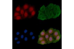 ABIN6261789 and ABIN6266775 staining Hela cells(45 min of heat-shock) by IF/ICC.