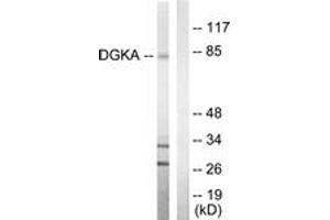 Western blot analysis of extracts from Jurkat cells, using DGKA Antibody. (DGKA 抗体  (AA 304-353))