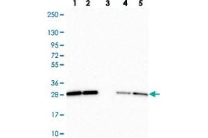 Western blot analysis of Lane 1: Human cell line RT-4 Lane 2: Human cell line U-251MG sp Lane 3: Human plasma (IgG/HSA depleted) Lane 4: Human liver tissue Lane 5: Human tonsil tissue with RBL1 polyclonal antibody  at 1:250-1:500 dilution. (p107 抗体)