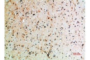 Immunohistochemical analysis of paraffin-embedded human-brain, antibody was diluted at 1:200 (CTLA4 抗体  (AA 41-90))