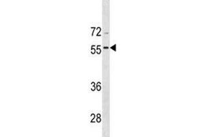 BMP8A antibody western blot analysis in CEM lysate (BMP8A 抗体  (AA 271-298))
