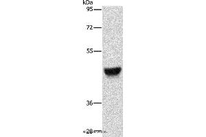 Western blot analysis of Human esophagus cancer tissue, using KRT13 Polyclonal Antibody at dilution of 1:500 (Cytokeratin 13 抗体)